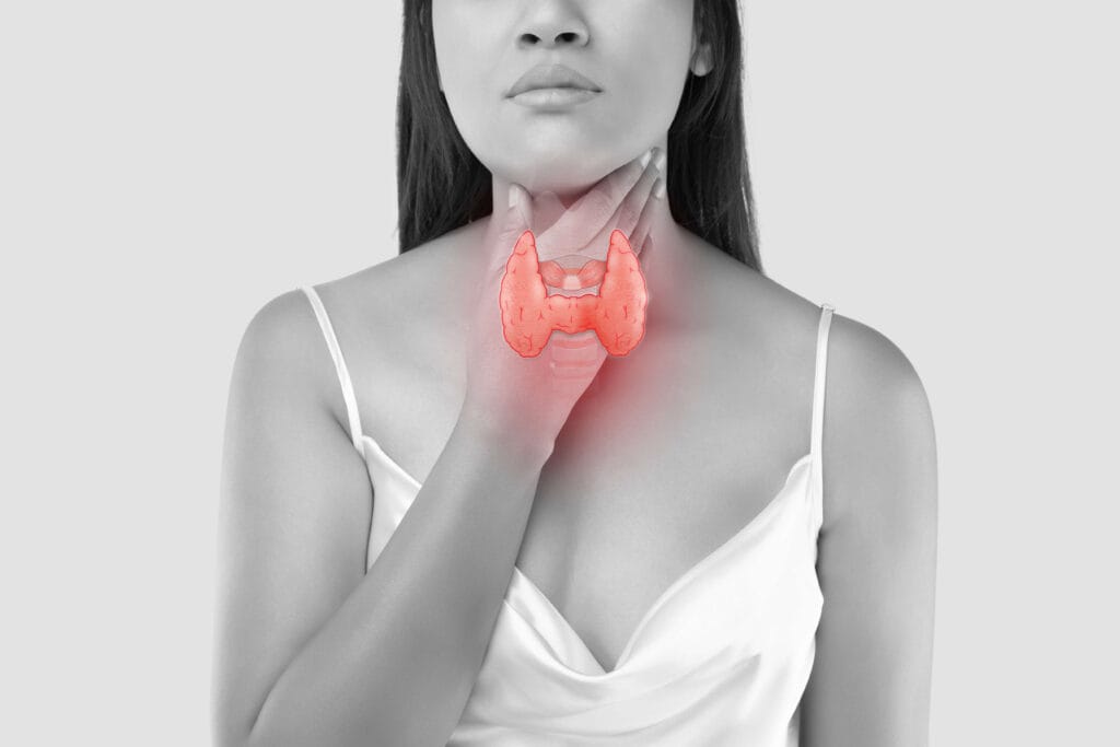 What is Hypothyroidism?